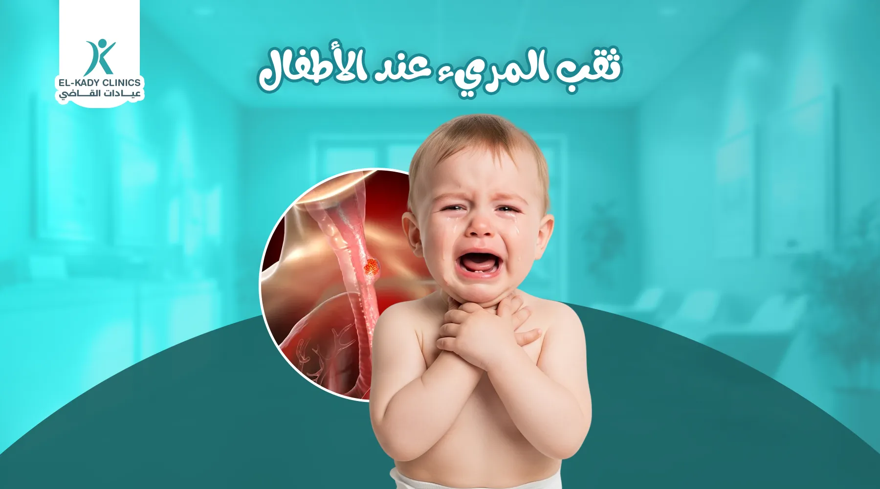 ثقب المريء عند الأطفال