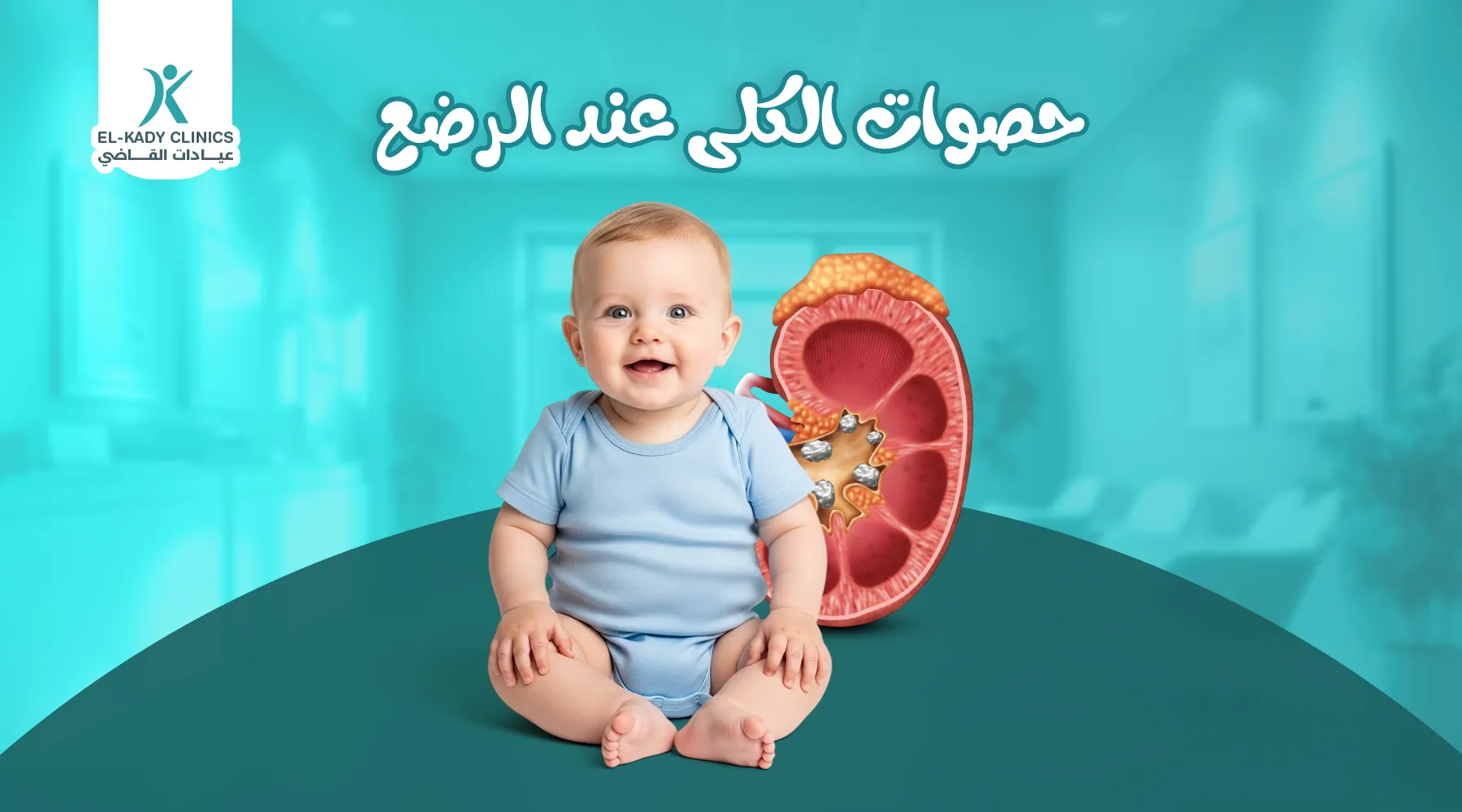 حصوات الكلى عند الرضع