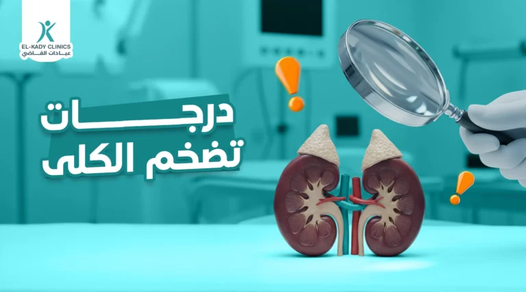درجات تضخم الكلى عند الجنين الذكر