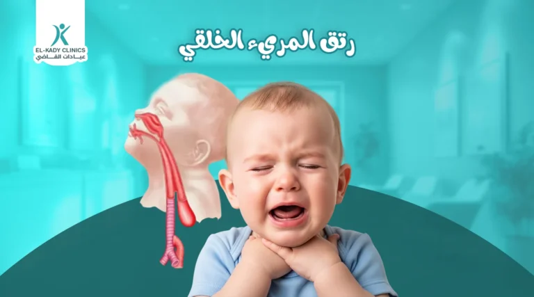 رتق المريء الخلقي: نسبة نجاح ومضاعفات عملية رتق المريء