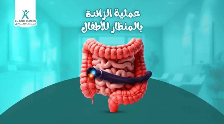 عملية الزائدة بالمنظار للأطفال