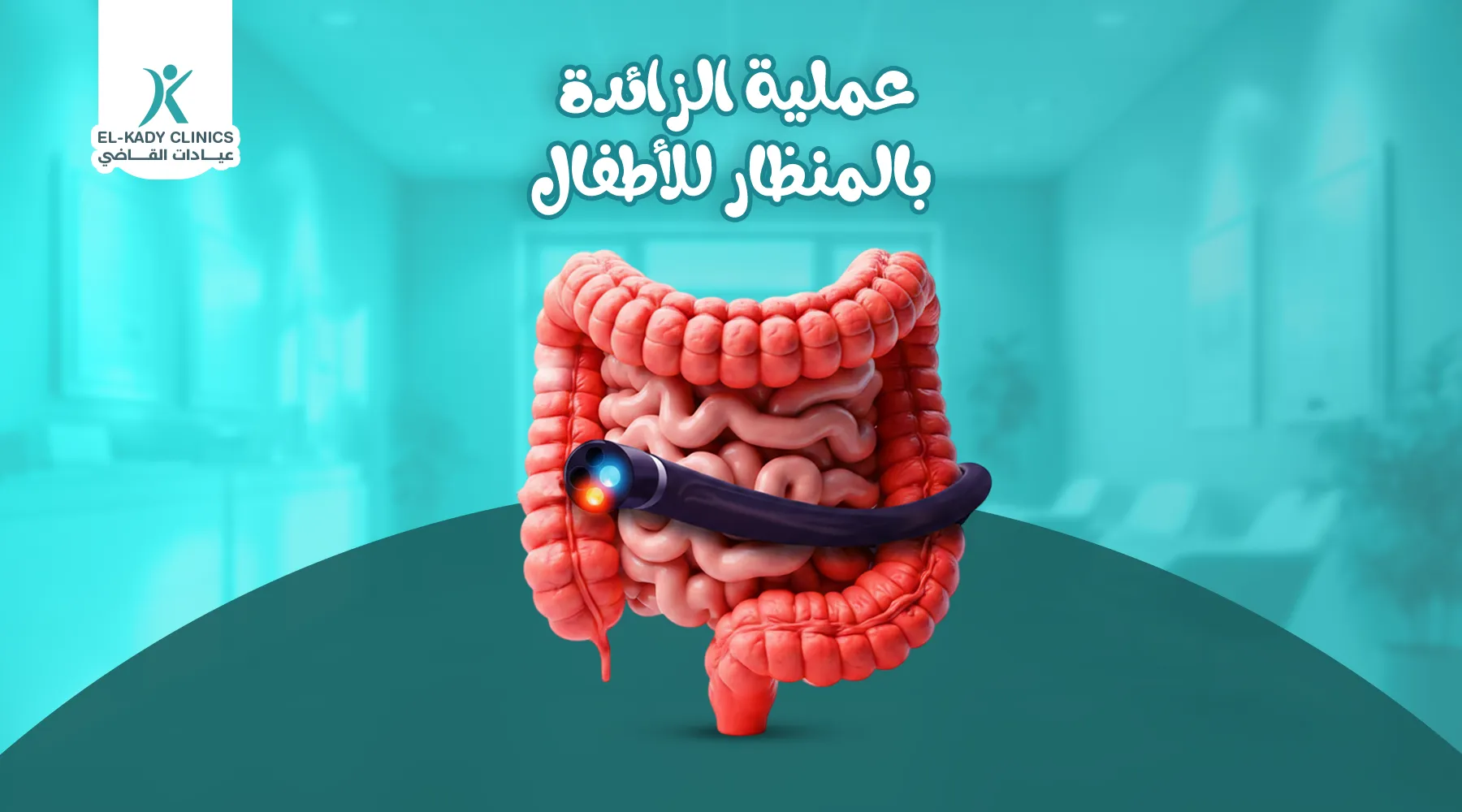 عملية الزائدة بالمنظار للأطفال