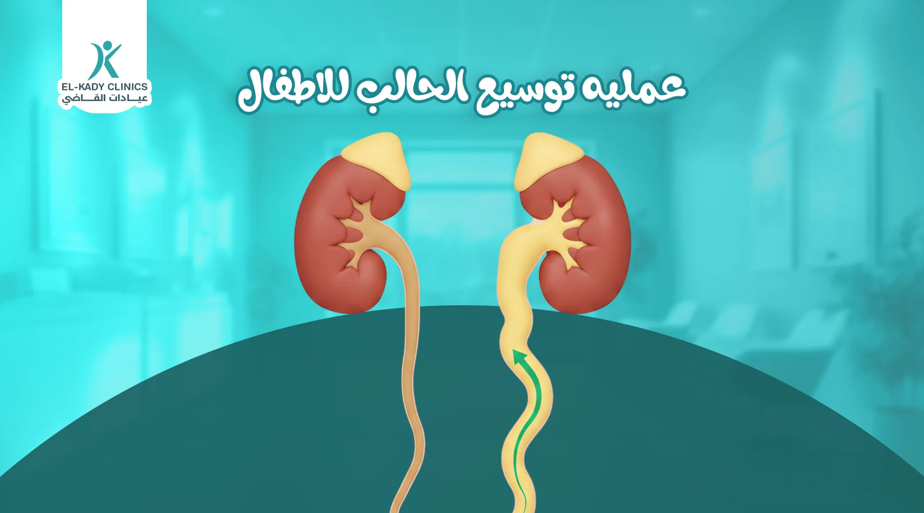عملية توسيع الحالب للأطفال