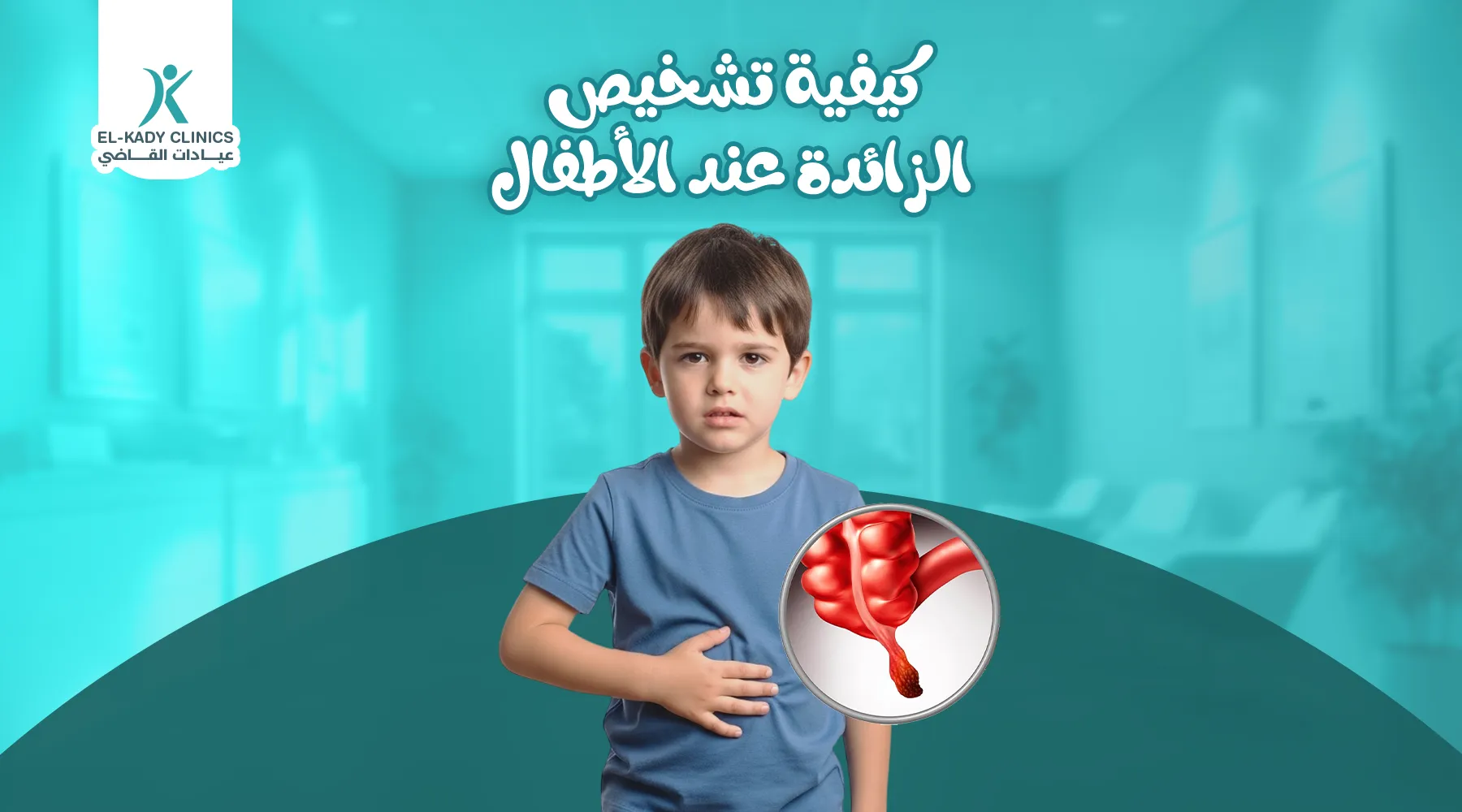 كيفية تشخيص الزائدة عند الأطفال: مكان الزايدة عند الأطفال وأعراضها