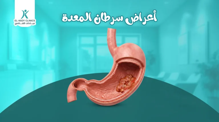 أعراض سرطان المعدة عند الأطفال وعلاجه