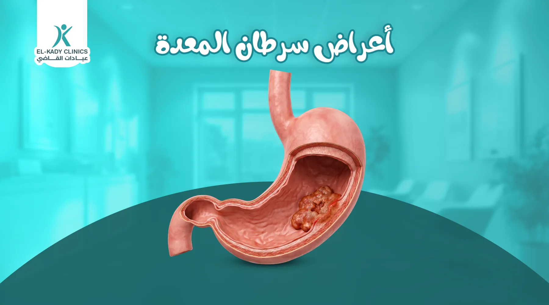 أعراض سرطان المعدة عند الأطفال وعلاجه