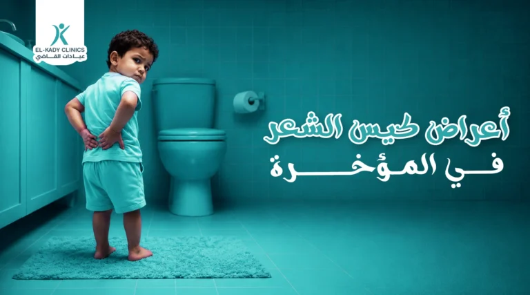 أعراض كيس الشعر في المؤخرة وعلاجه عند الأطفال