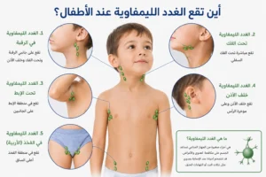 أين تقع الغدد الليمفاوية عند الأطفال بالصور؟