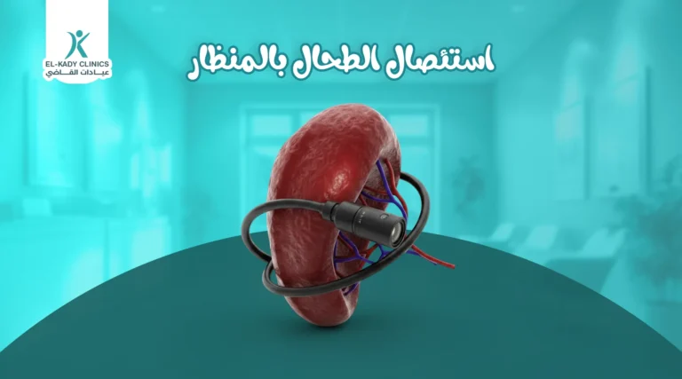 استئصال الطحال بالمنظار للأطفال