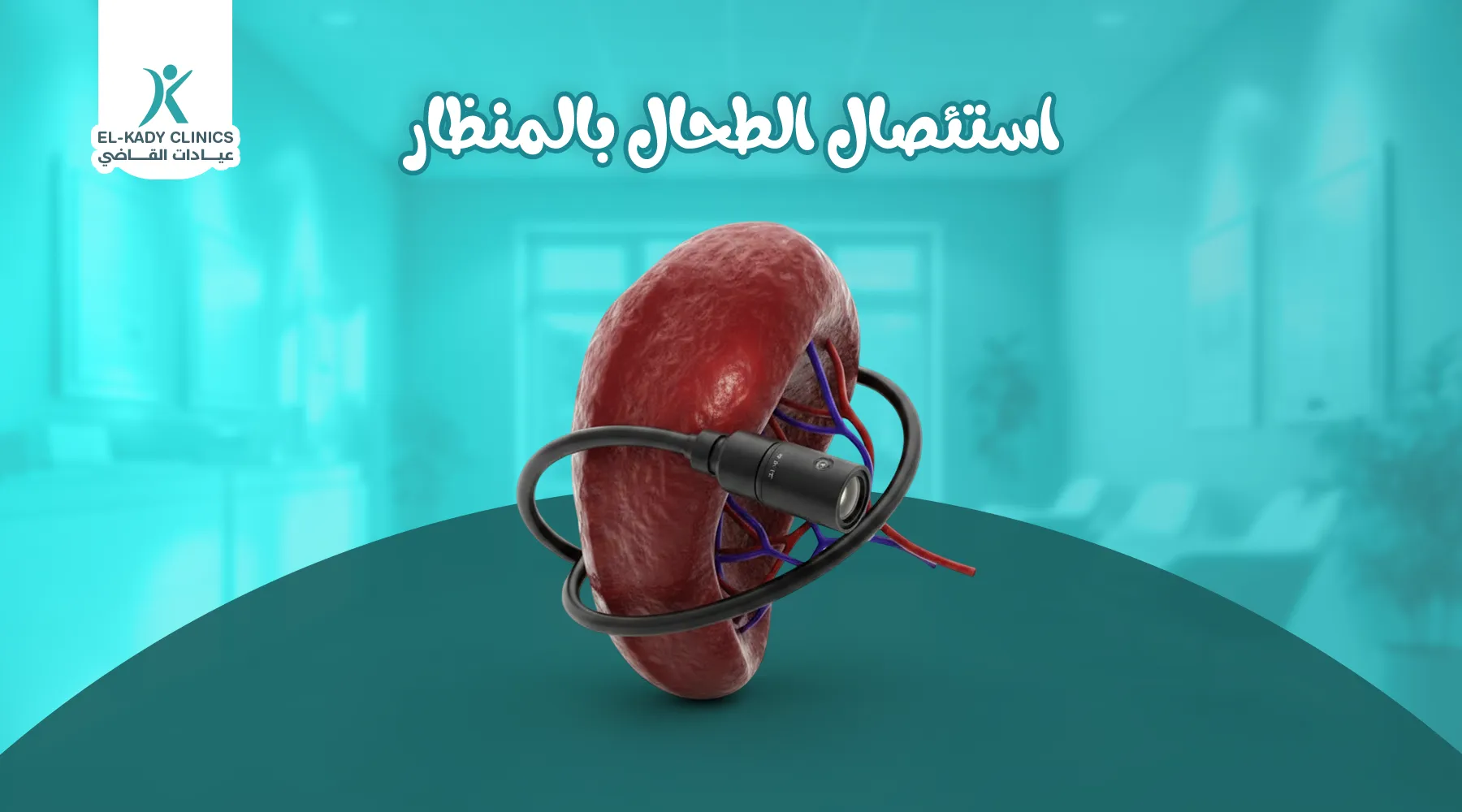 استئصال الطحال بالمنظار للأطفال