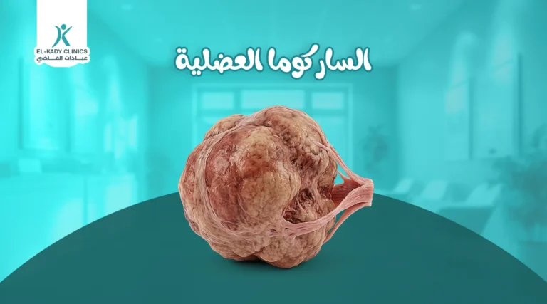 الساركوما العضلية عند الأطفال