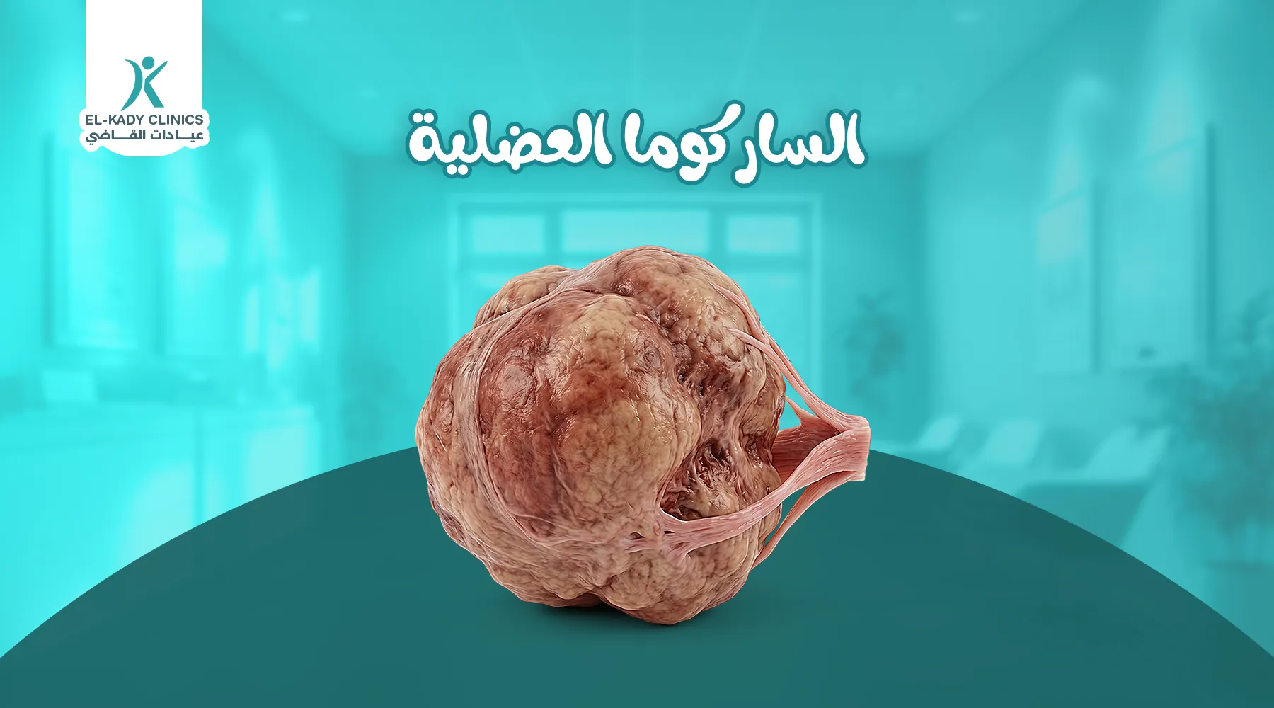 الساركوما العضلية عند الأطفال