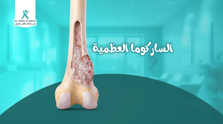 الساركوما العظمية عند الأطفال