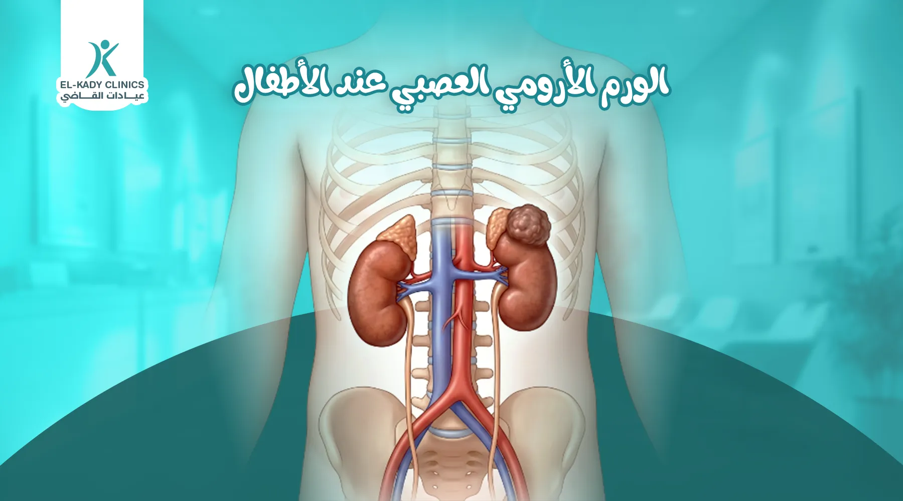 الورم الأرومي العصبي عند الأطفال: سرطان النيوروبلاستوما