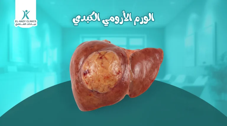 الورم الأرومي الكبدي عند الأطفال