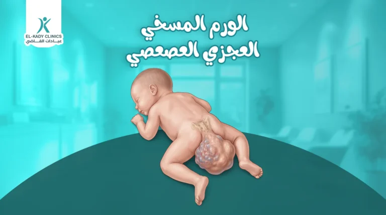 الورم المسخي العجزي العصعصي