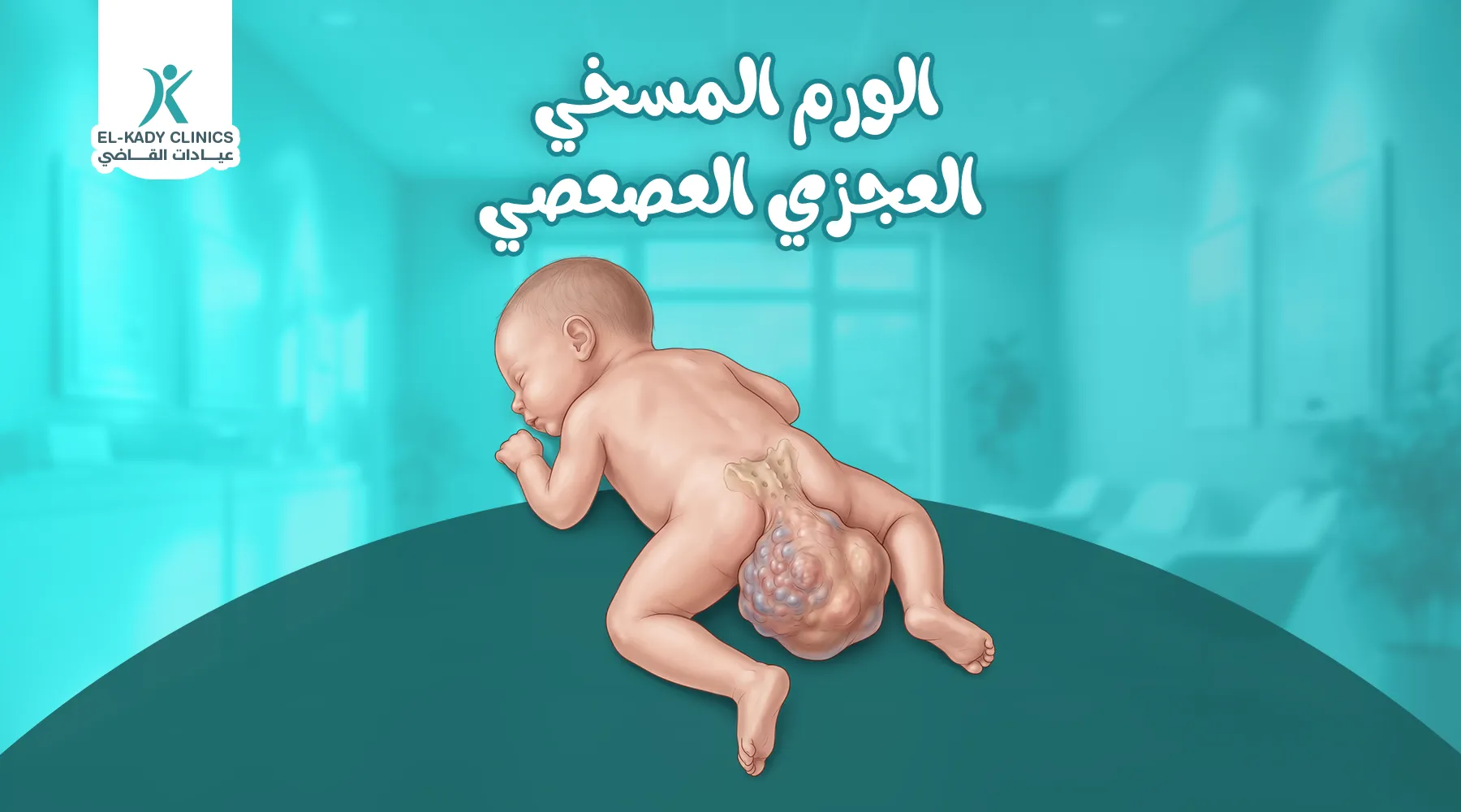 الورم المسخي العجزي العصعصي