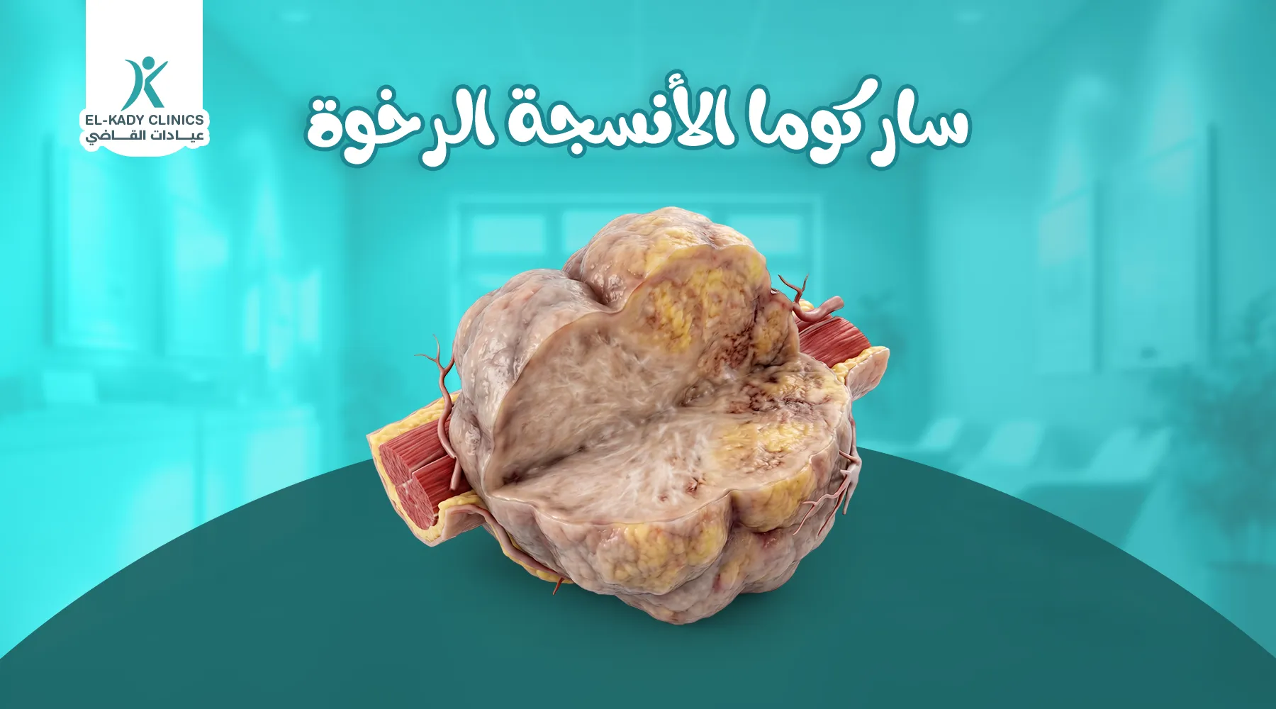 ساركوما الأنسجة الرخوة عند الأطفال: كتلة عند الطفل هل خطيرة؟