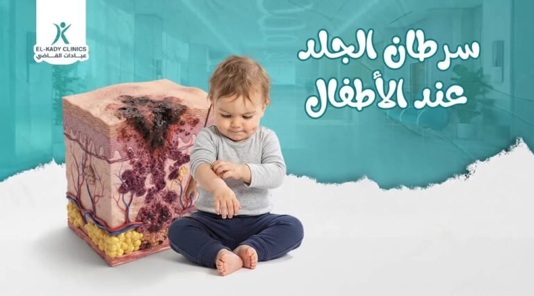سرطان الجلد عند الأطفال