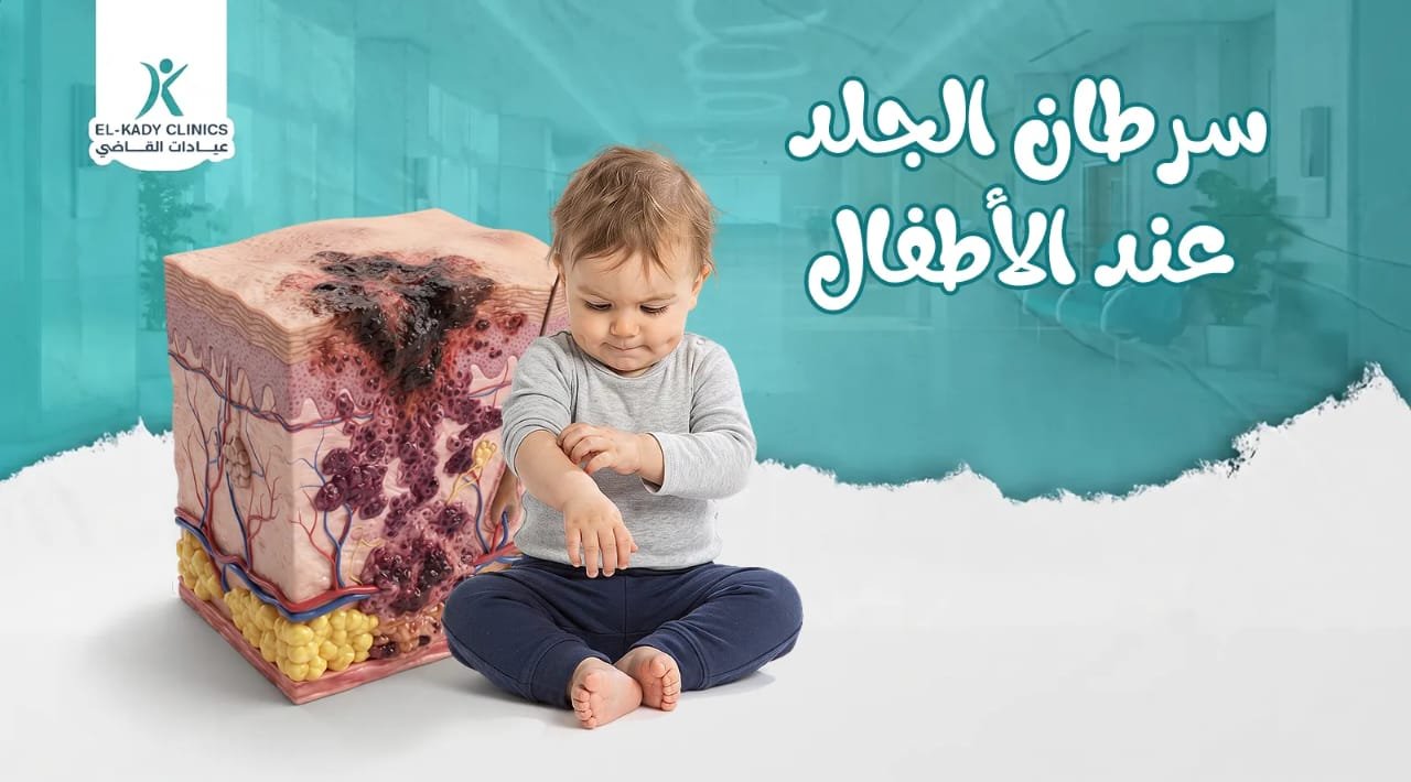 سرطان الجلد عند الأطفال