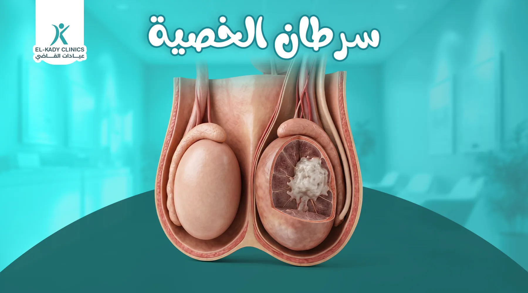 سرطان الخصية عند الأطفال
