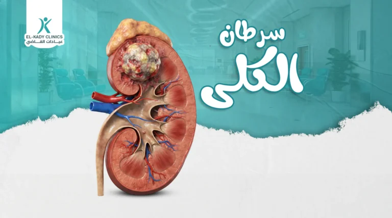 سرطان الكلى عند الأطفال