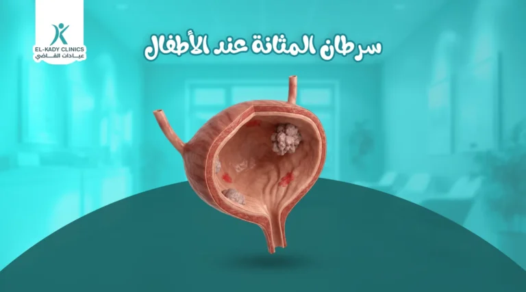 سرطان المثانة عند الأطفال
