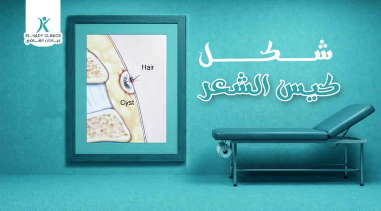 شكل كيس الشعر بالصور....كيف يكون شكل كيس الشعر في بدايته؟