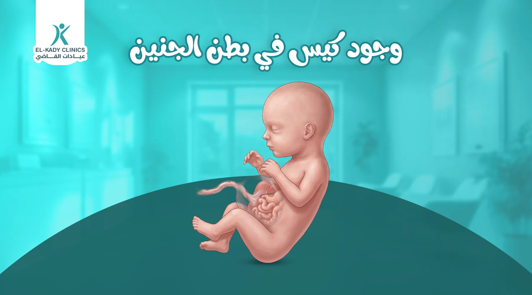 ماذا يعني وجود كيس في بطن الجنين؟