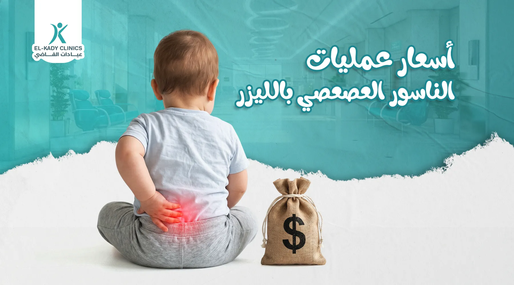 أسعار عمليات الناسور العصعصي بالليزر للأطفال في مصر 2026