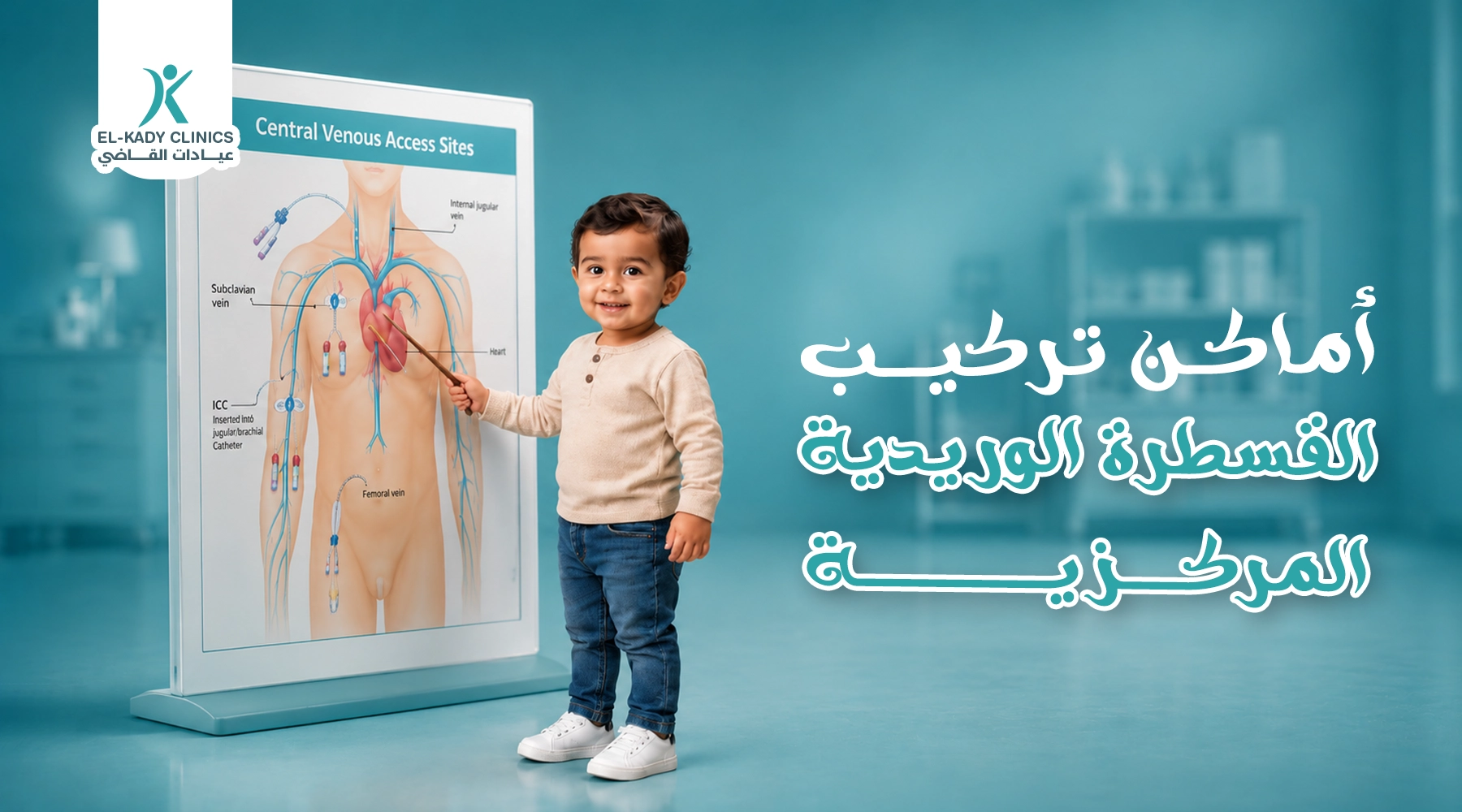 أماكن تركيب القسطرة الوريدية المركزية للأطفال