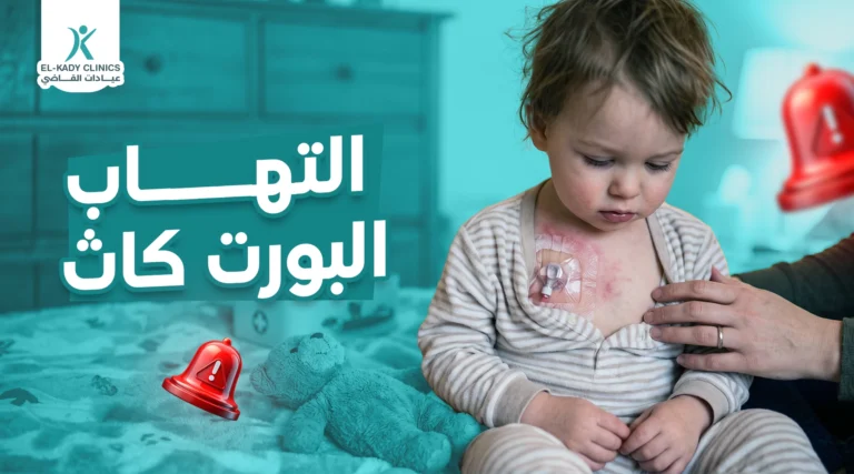 التهاب البورت كاث عند الأطفال: أسبابه وعلاجه