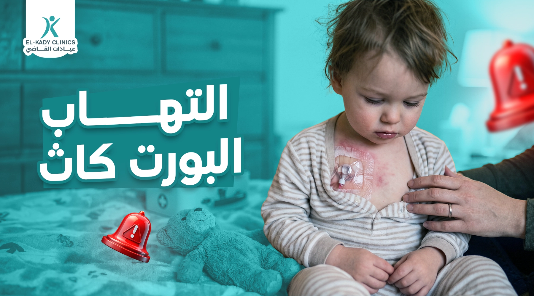 التهاب البورت كاث عند الأطفال: أسبابه وعلاجه