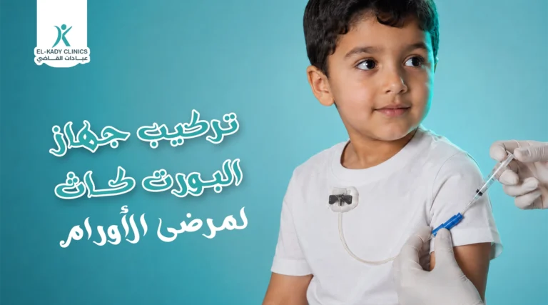 كيفية تركيب جهاز البورت كاث لمرضى الأورام من الأطفال