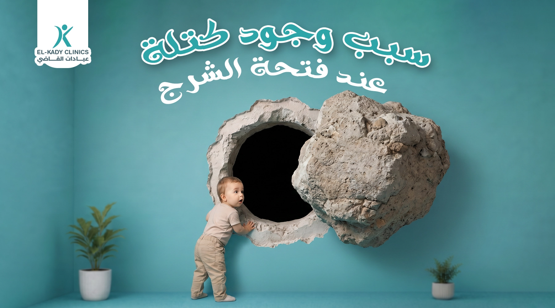 سبب وجود كتلة عند فتحة الشرج لدى الأطفال