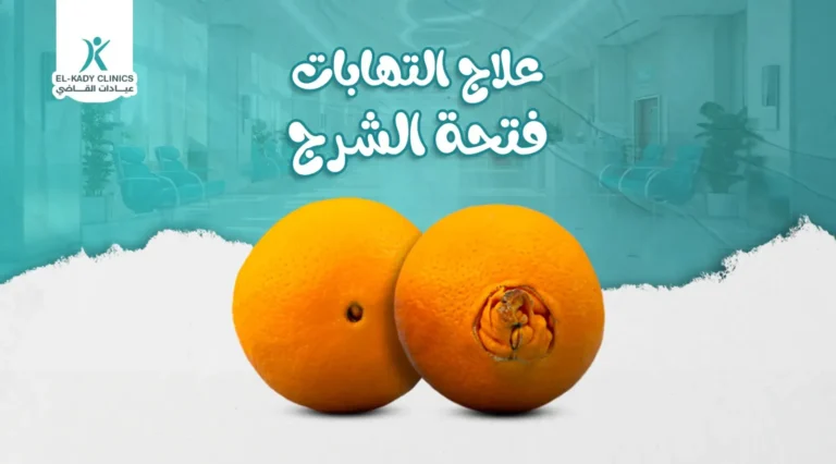 علاج التهابات فتحة الشرج