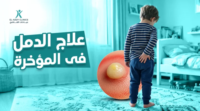 علاج الدمل في المؤخرة للأطفال منزلياً وجراحياً