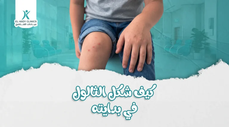 كيف شكل الثالول في بدايته لدى الأطفال؟