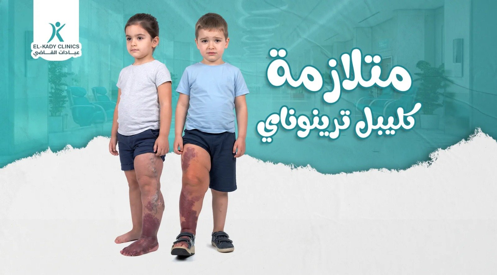 متلازمة كليبل ترينوناي