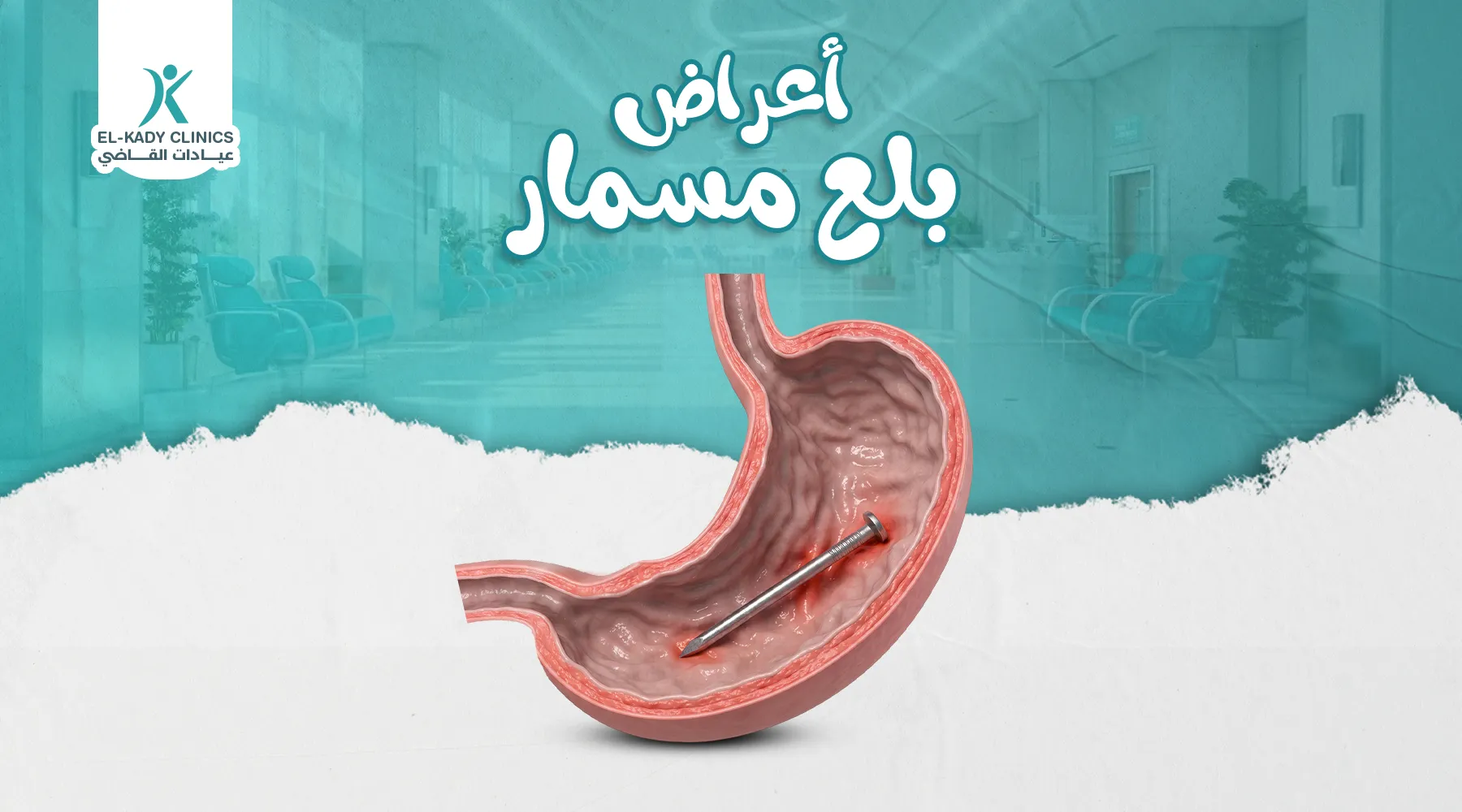 أعراض بلع مسمار عند الأطفال