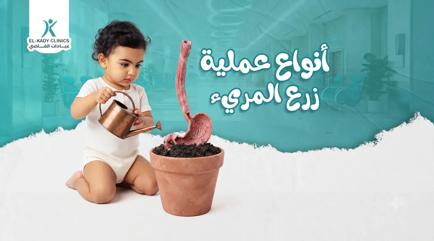 أنواع عملية زراعة المريء للأطفال مع د. رضا القاضي