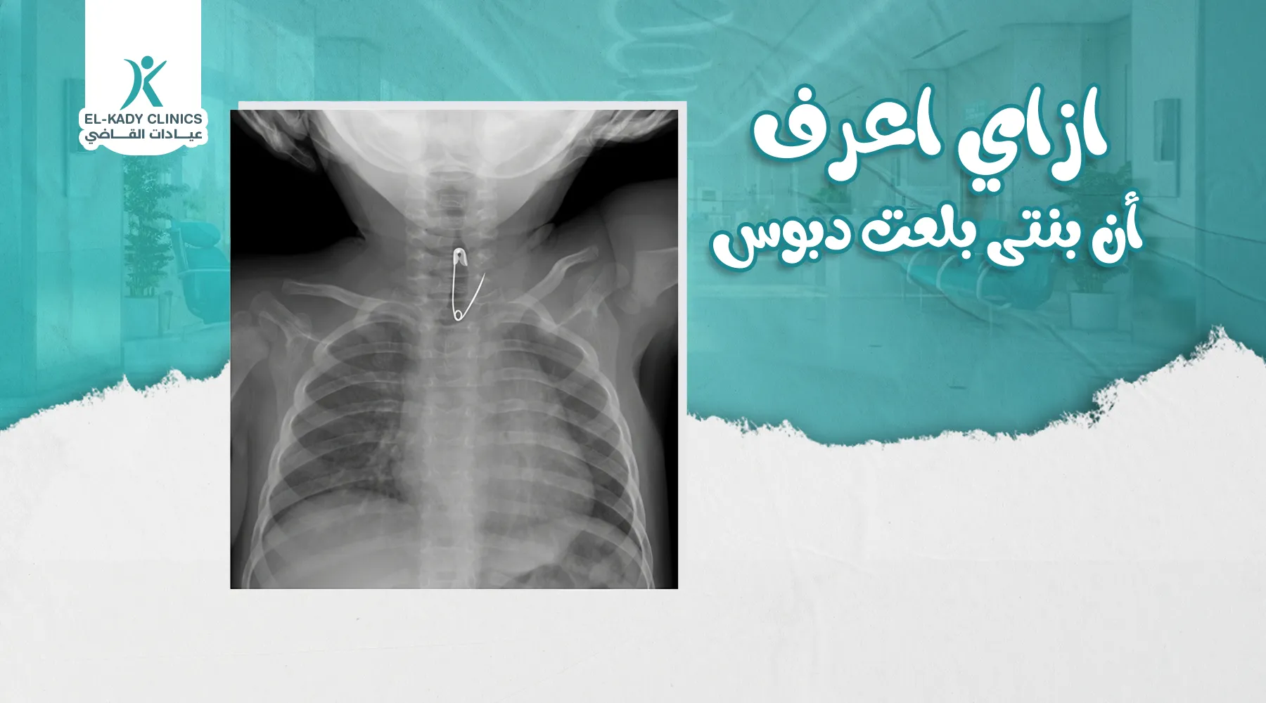 ازاي اعرف أن بنتي بلعت دبوس؟ هل بلع الدبوس خطر؟