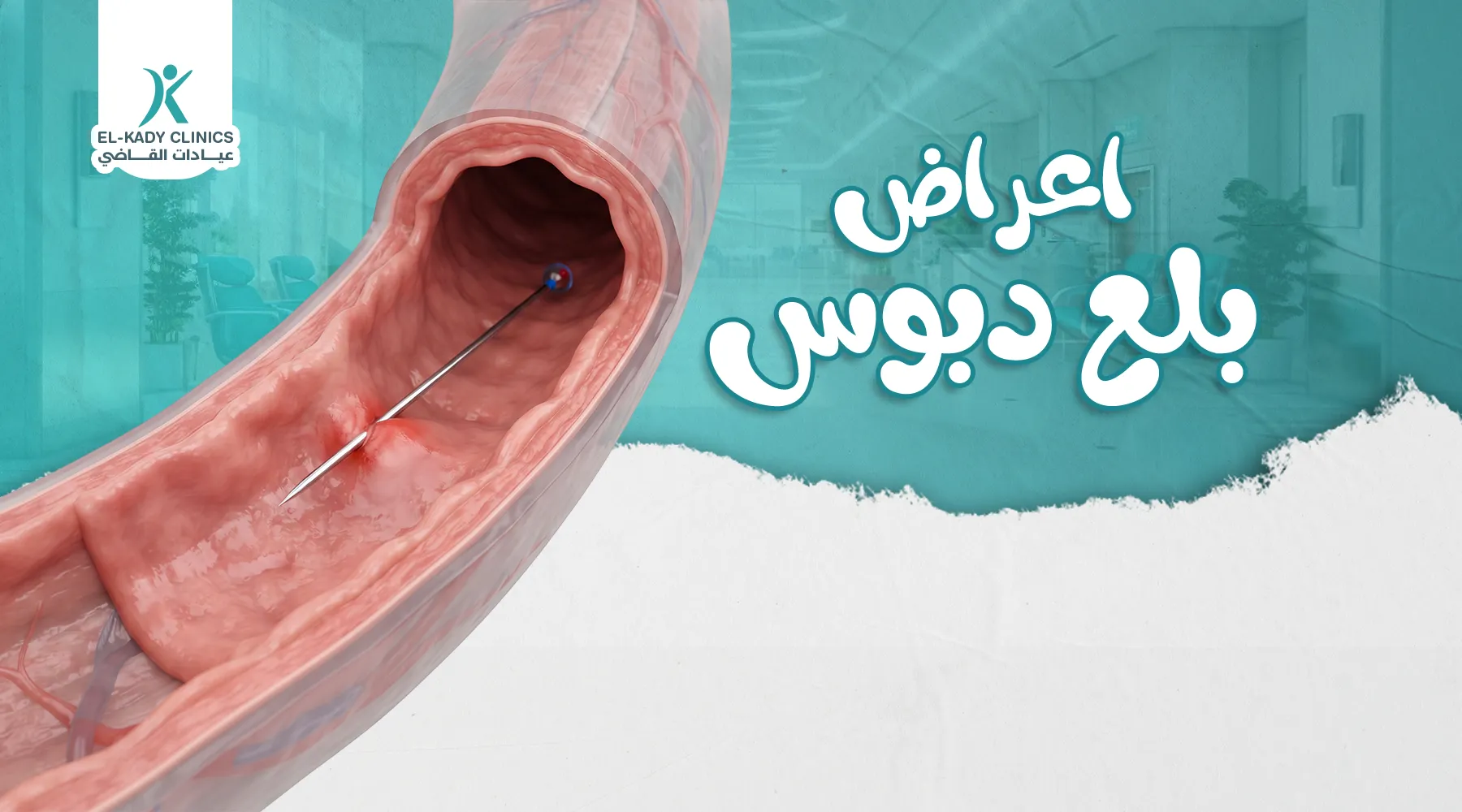 أعراض بلع دبوس عند الأطفال والعلاج بالتفصيل