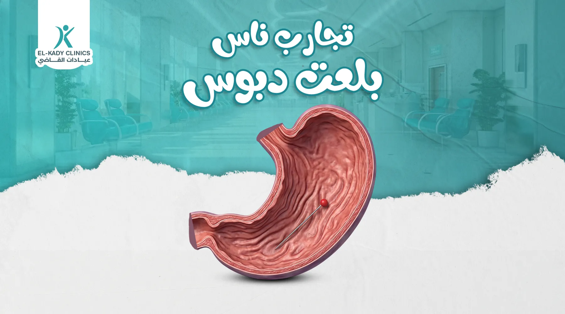 تجارب ناس بلعت دبوس