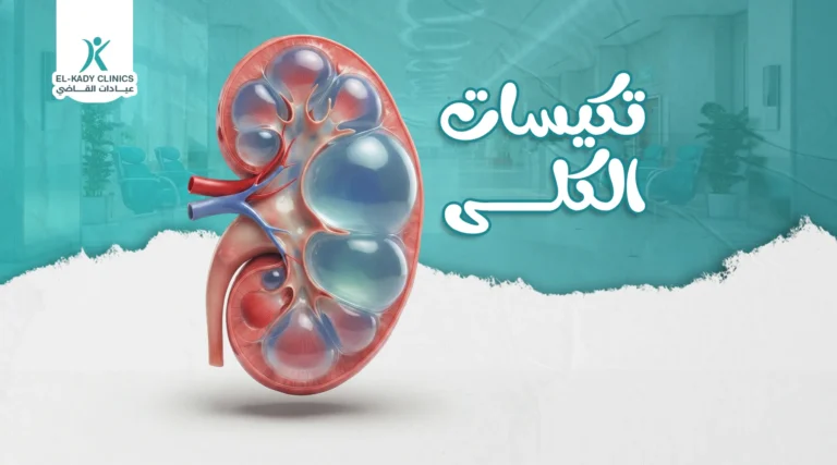 أنواع تكيسات الكلى عند الأطفال وأعراضها وطرق العلاج