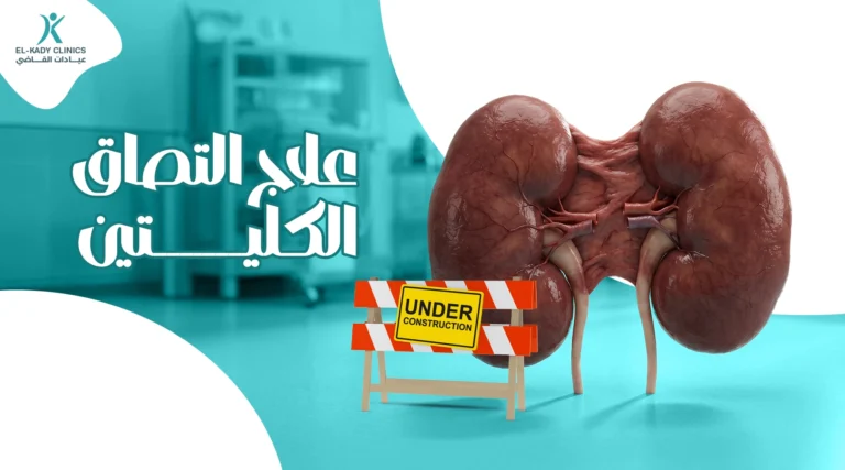 علاج التصاق الكليتين عند الأطفال