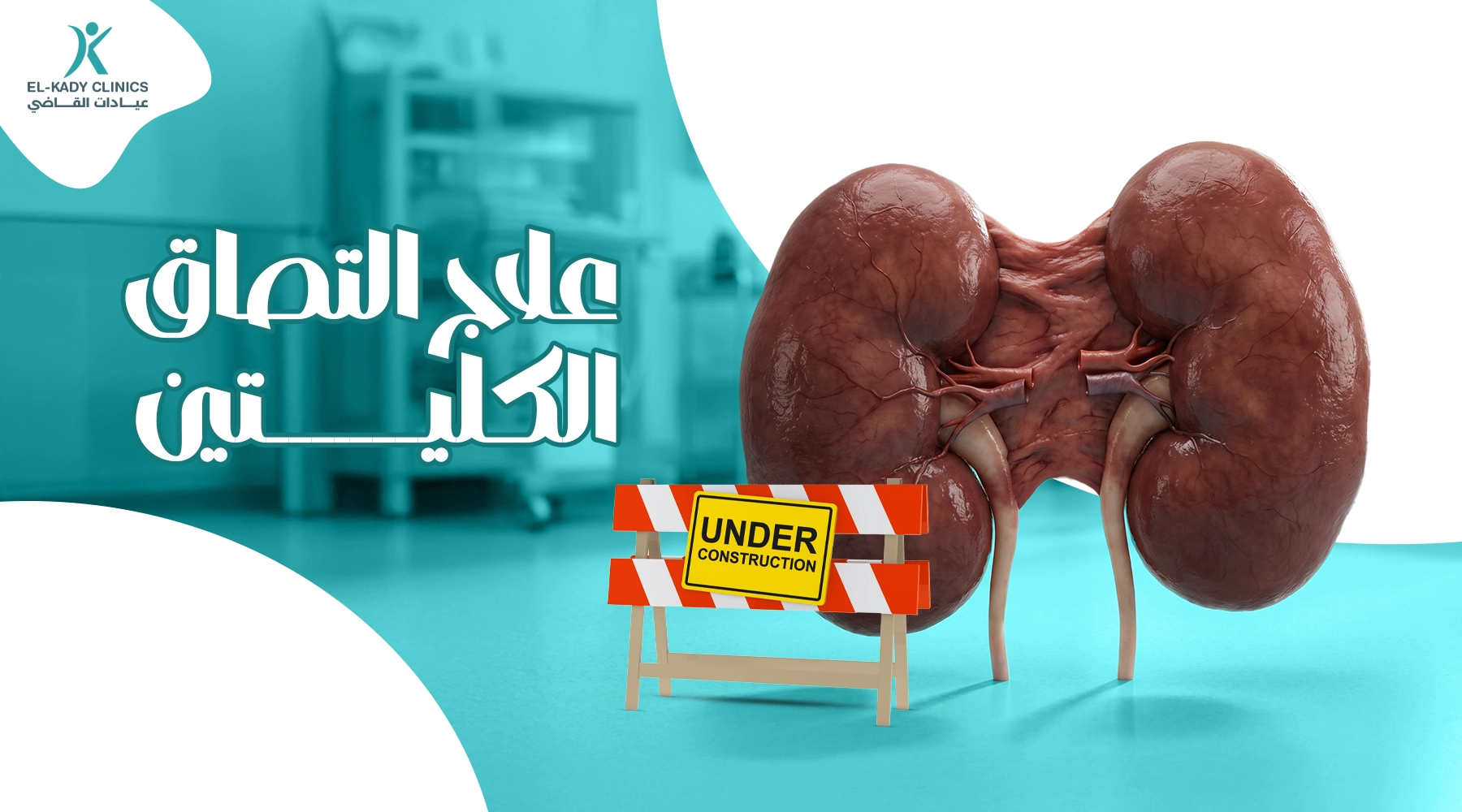 علاج التصاق الكليتين عند الأطفال