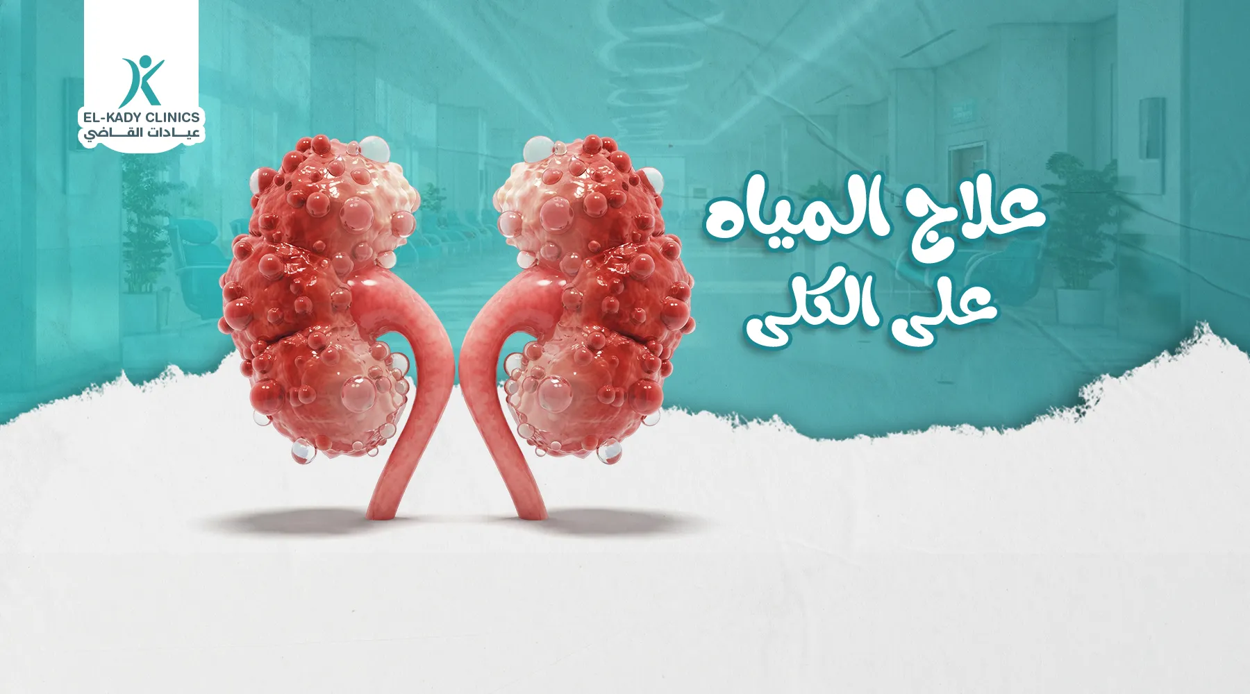علاج المياه على الكلى عند الأطفال مع د. رضا القاضي