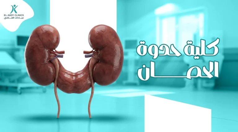 كلية حدوة الحصان