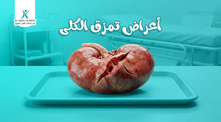 أعراض تمزق الكلى وعلاجه عند الأطفال